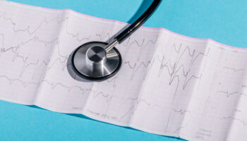A stethoscope laid over an echocardiogram, representing atrial fibrillation and the rise of the pulsed field ablation market