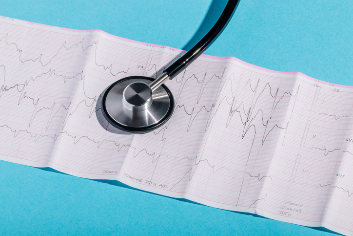 A stethoscope laid over an echocardiogram, representing atrial fibrillation and the rise of the pulsed field ablation market